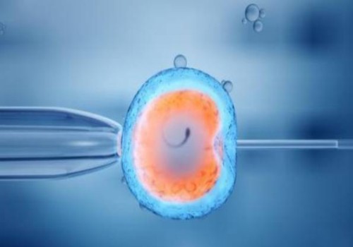 羊水穿刺染色體報(bào)告解讀：是男孩還是女孩一目了然！